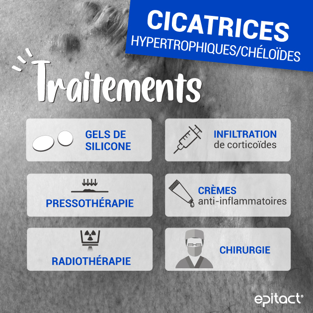 Traiter la cicatrice hypertrophique & chéloïde : injection de cortisone ...